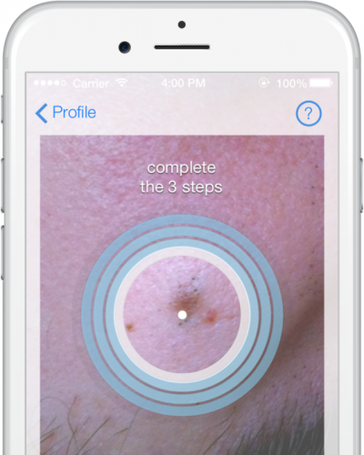 SkinVision, platforma care permite interactiunea in mediul online dintre medici si pacienti
